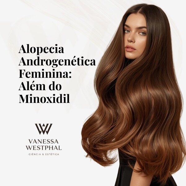 Aula Alopecia Androgenética Feminina
